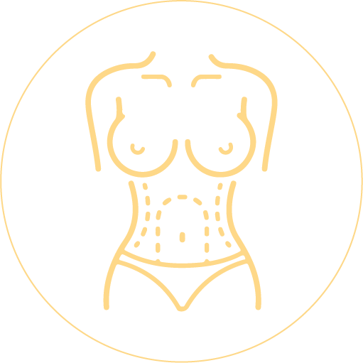 Abdominoplastia total